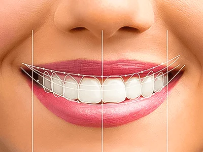 Why Digital Smile Design is the Future of Smile Makeovers Smile Design